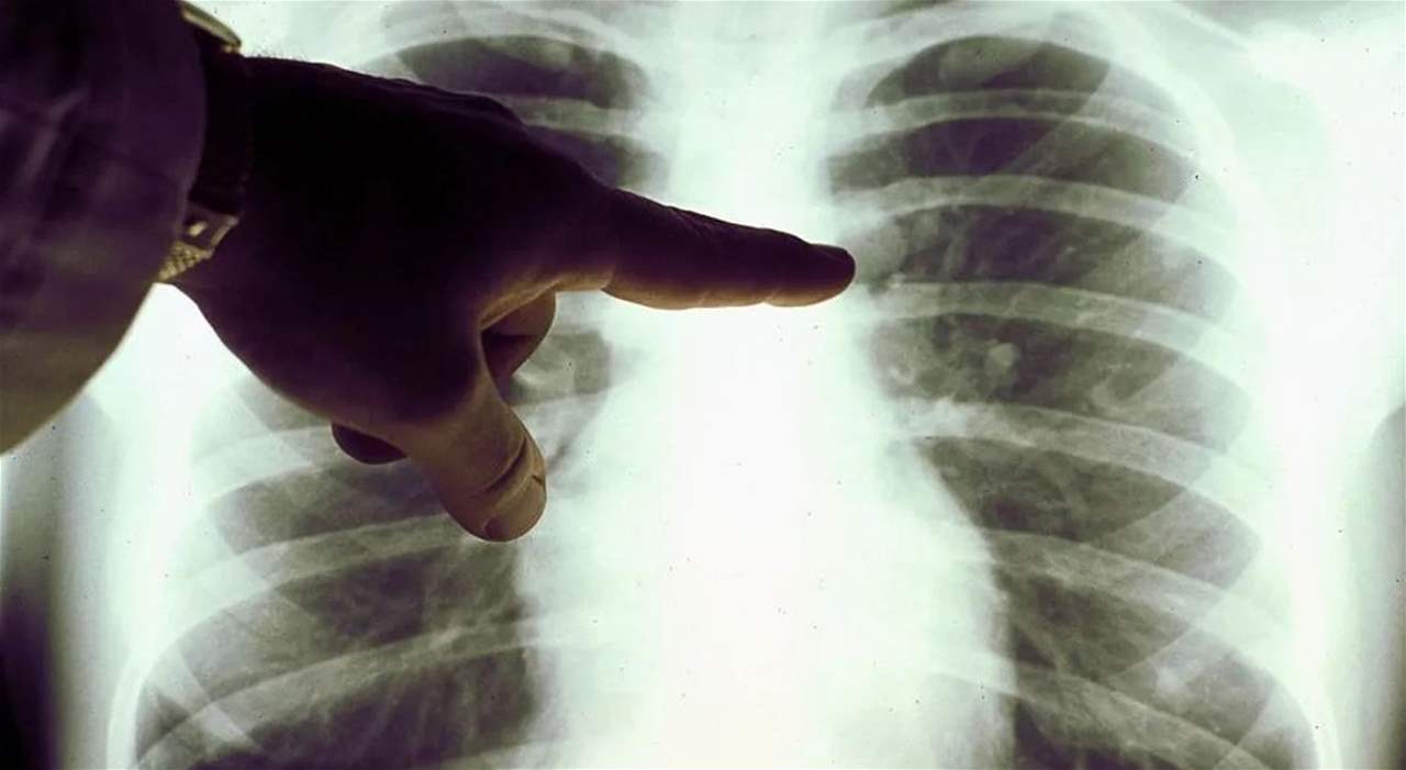 هل ظهر &quot;مرض تنفسي جديد&quot; في الصين؟.. منظمة الصحة العالمية توضّح