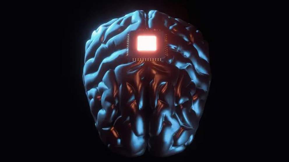 لعلاج الوسواس القهري.. عملية "ثورية" لزرع شريحة إلكترونية داخل دماغ إمرأة