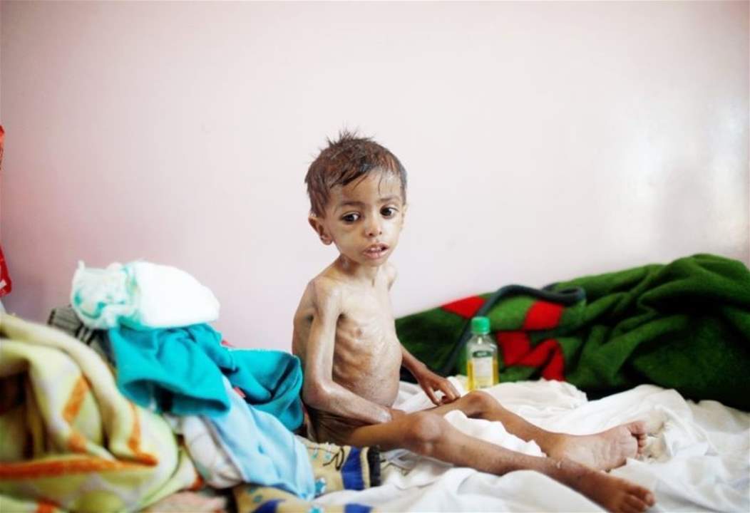 الغارديان: معاناة المدنيين في اليمن ليست أسوأ أزمة إنسانية!