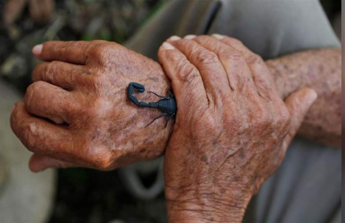 لدغة العقرب علاج للألم... ربما تؤخر نمو الأورام لدى بعض مرضى السرطان!؟