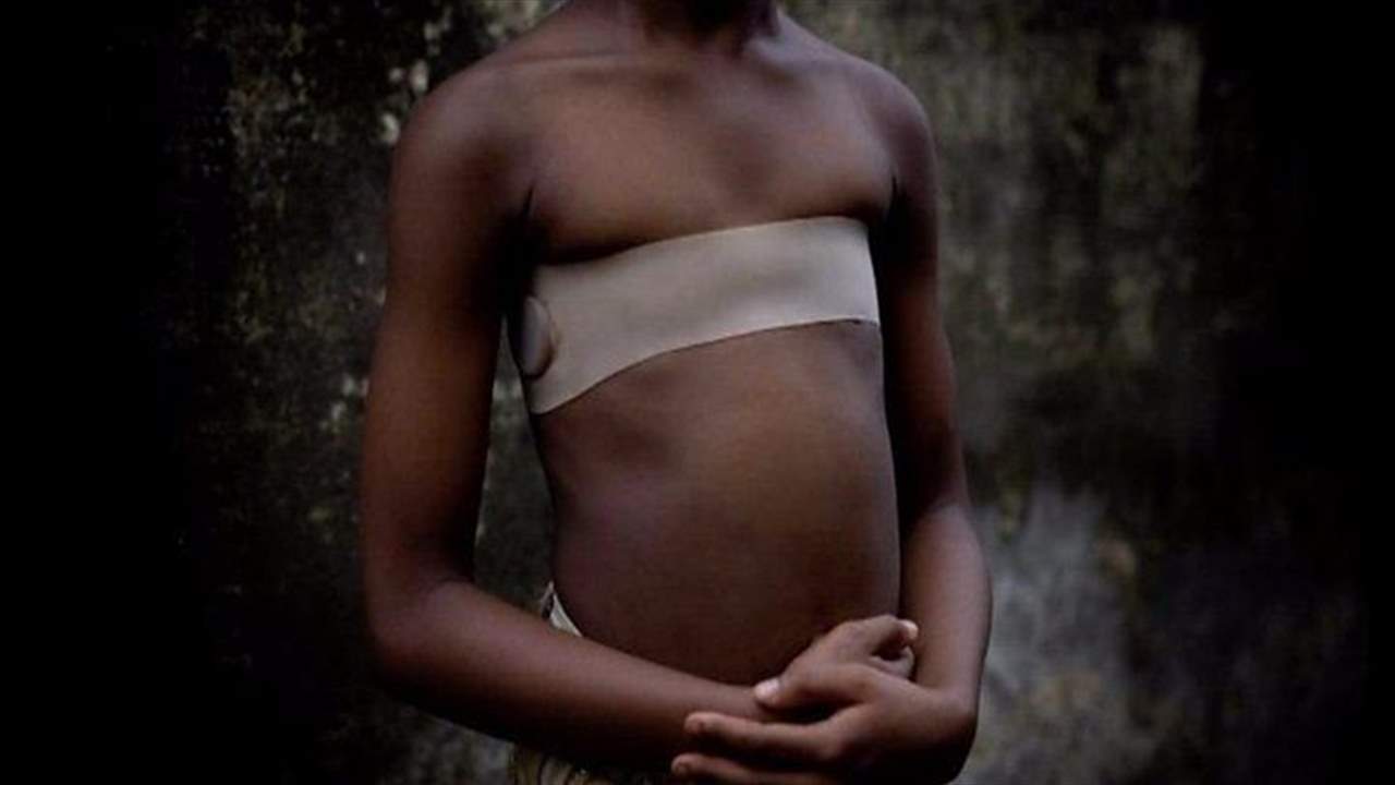  "كي الثدييْن"... حتى لا تجذب الفتيات الرجال!