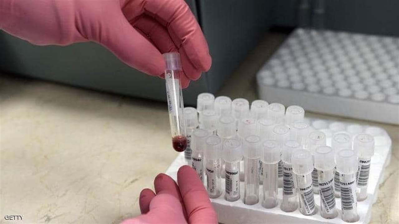  أطباء يزيلون فيروس "الإيدز" من جينات حيّة تحمل الفيروس