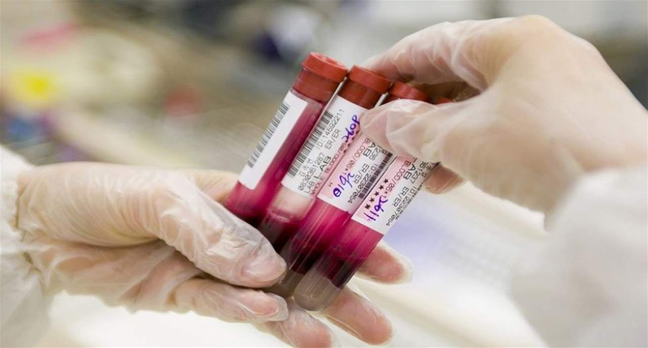 مرض الزهري ينتشر في أوروبا.. ارتفاع عدد الإصابات بنسبة 70%! 