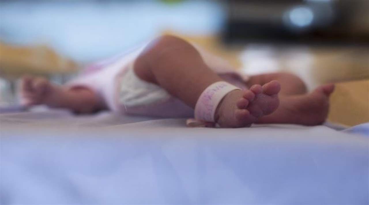 بالصور - ولادة طفلة بـ"ثلاثة رؤوس" تذهل الأطباء!