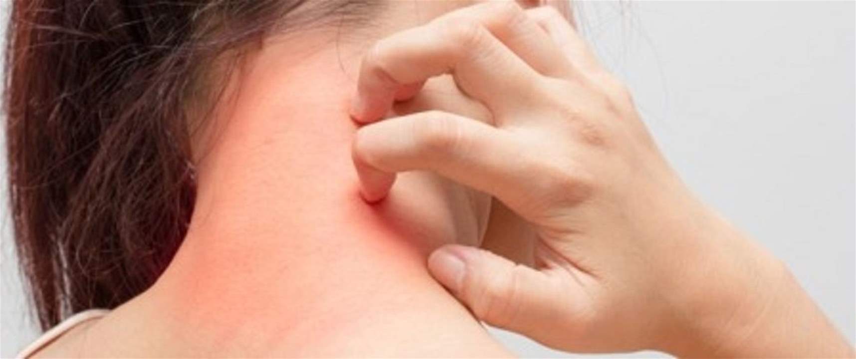 علامات في الجسم قد تكون دليلًا على الإصابة بسرطان الدم