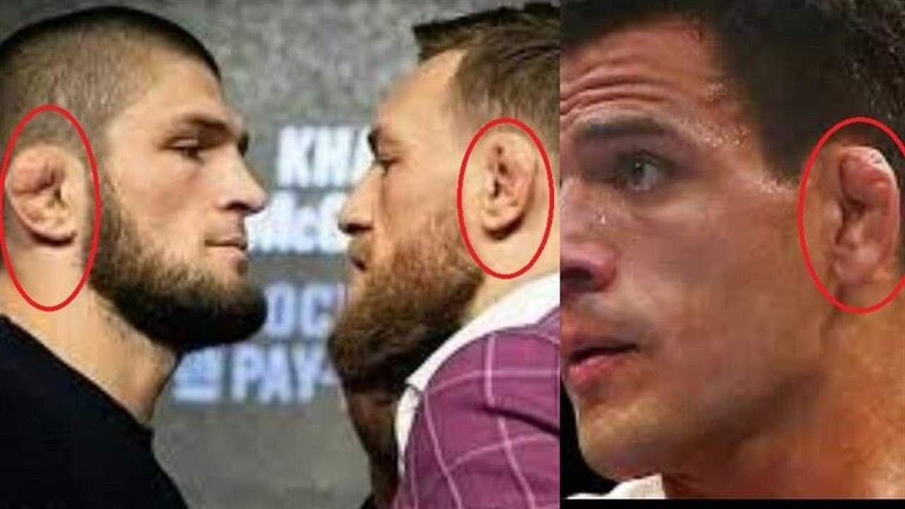 شرح للسبب الذي يؤدي إلى تشوه آذان المقاتلين