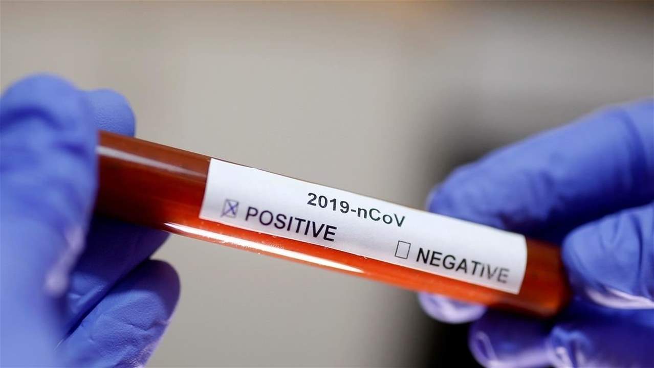 وزارة الصحة: اعتماد مختبرات جديدة لفحص الفيروس بتعرفة 150 ألف ليرة كحد أقصى