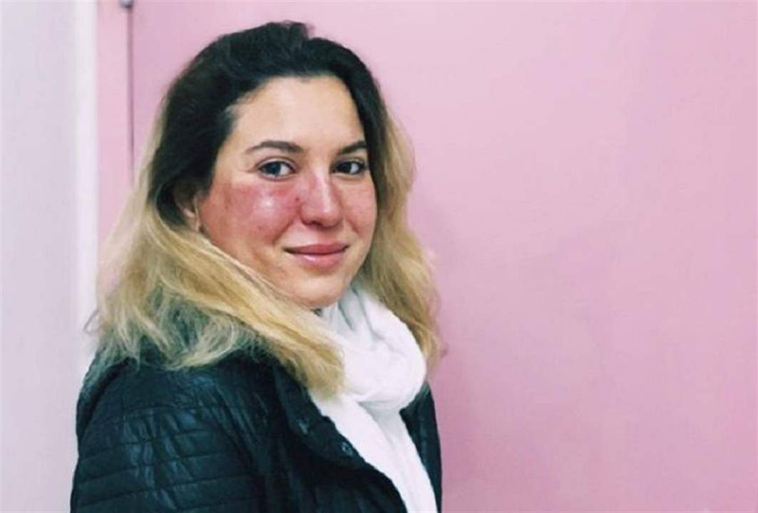 فنانة لبنانية انتصرت على مرض السرطان .. تروي تجربتها للجمهور!