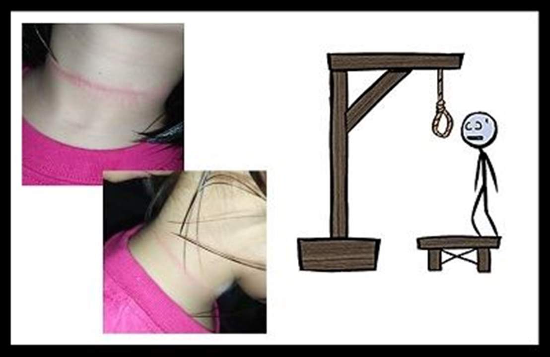 وفاة طفلين في إيطاليا وتشيلي بسبب لعبة "الجلاد" ونجاة طفلة بالصدفة