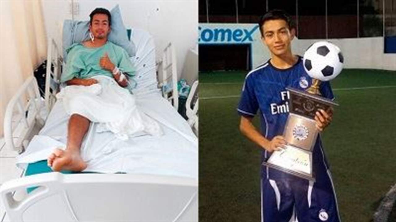 لاعبٌ يتلقى صعقة كهربائية .. ينجو من الموت ويخسر قدمه