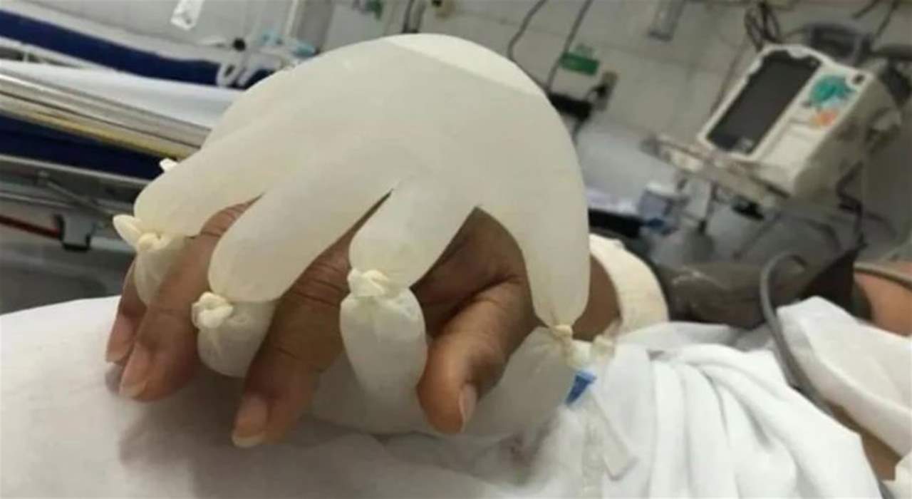  في البرازيل .. ممرضة تدعم مرضى كورونا بفكرة مميزة 