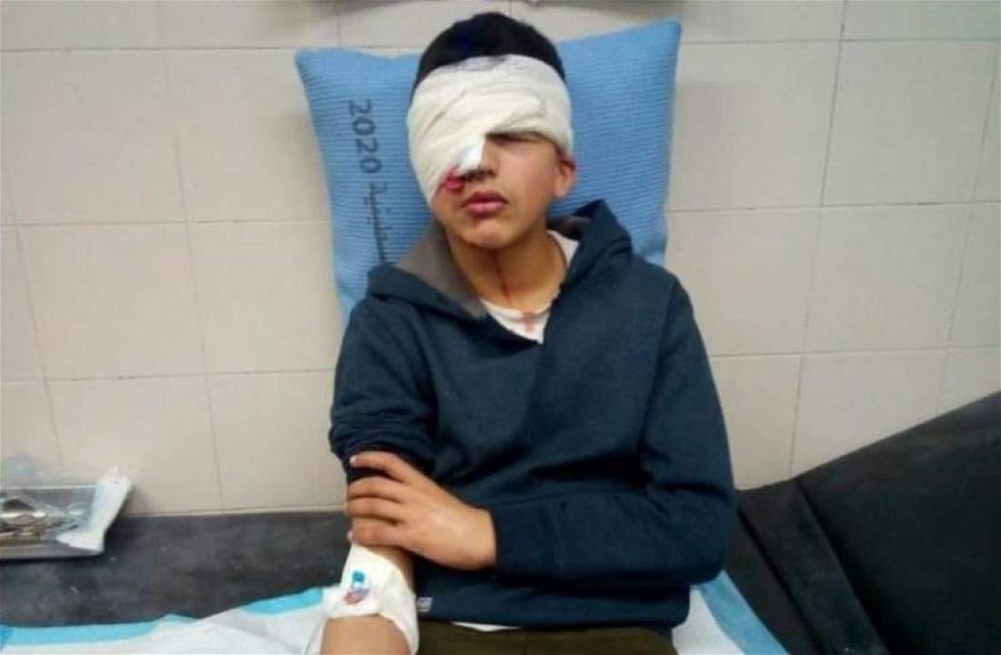 رصاص العدو الاسرائيلي يُطفئ عين الطفل الفلسطيني عز الدين البطش