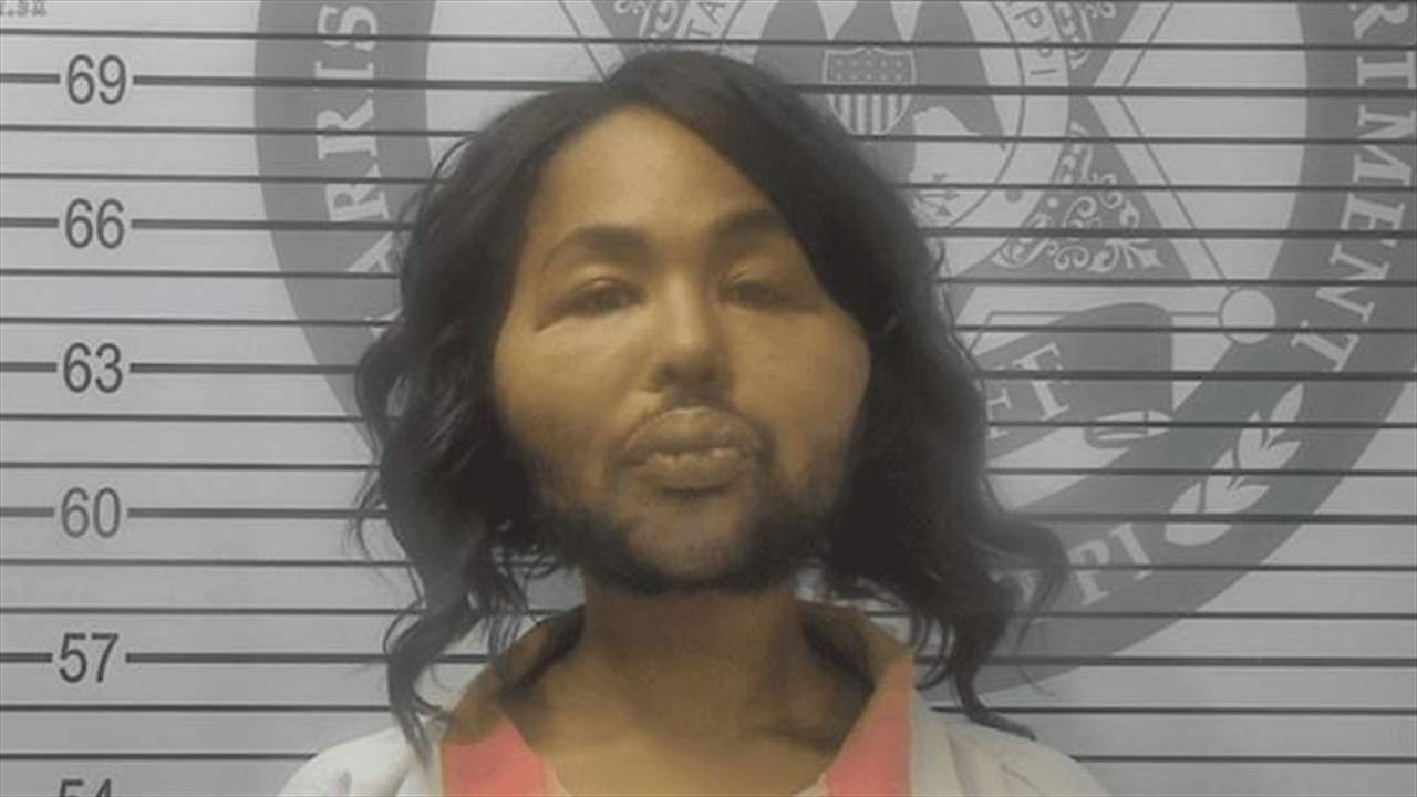 امرأة تعترف بالسطو على مصرف لتجميل وجنتيها وشفتيها