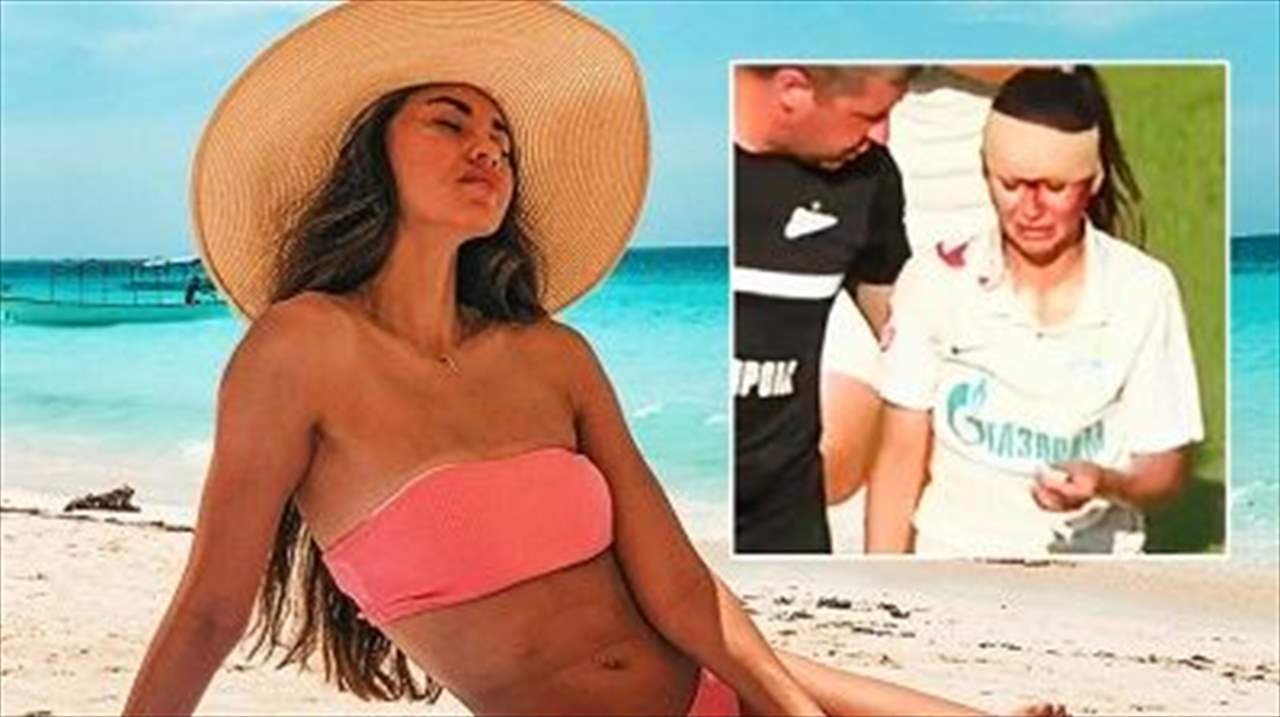 بالصور - ضربة قاسية على الرأس أخرجت النجمة إلى المستشفى