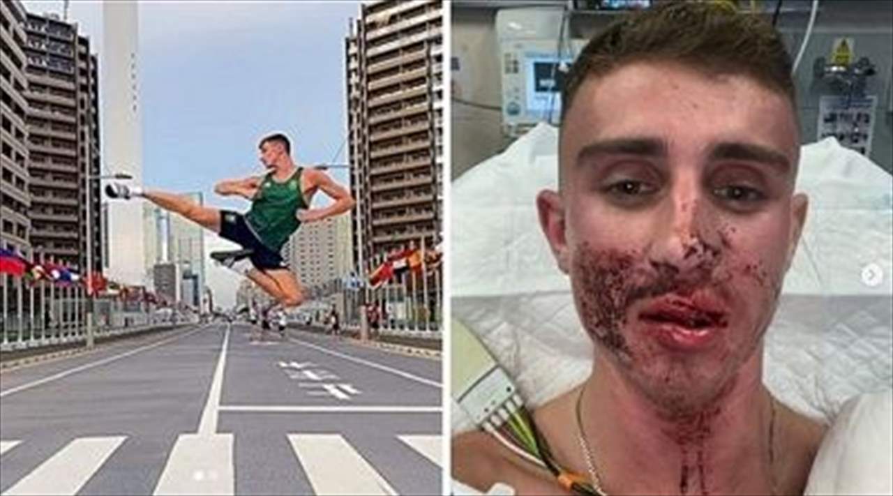 صور: اعتداء شرس على البطل الأولمبي تركه بوجه مشوّه وجروح خطيرة