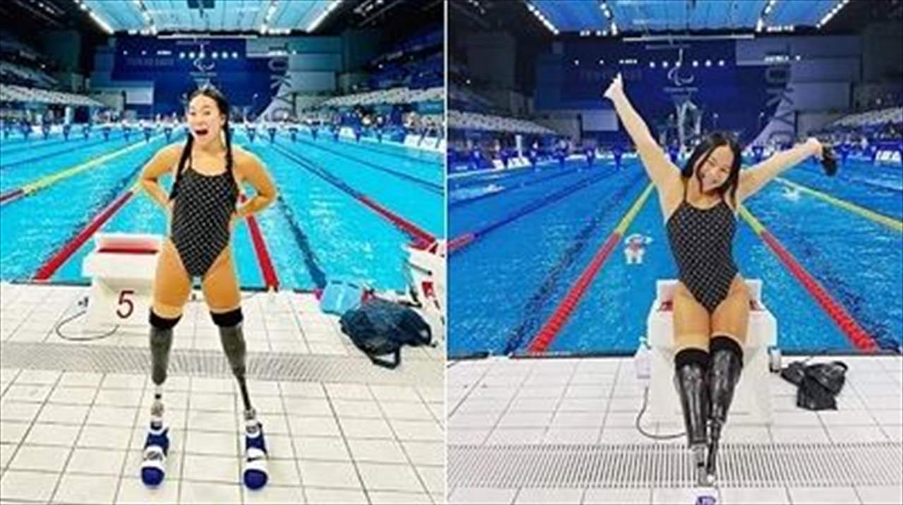 بالصور - "الفتاة المعجزة" التي نجت من قنبلة انتحر بها والديها