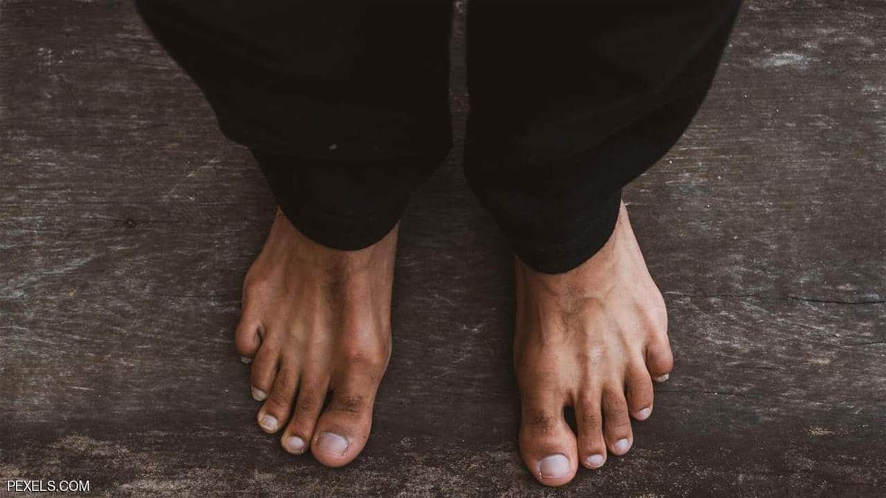 أحدث أعراض كورونا "في القدمين"