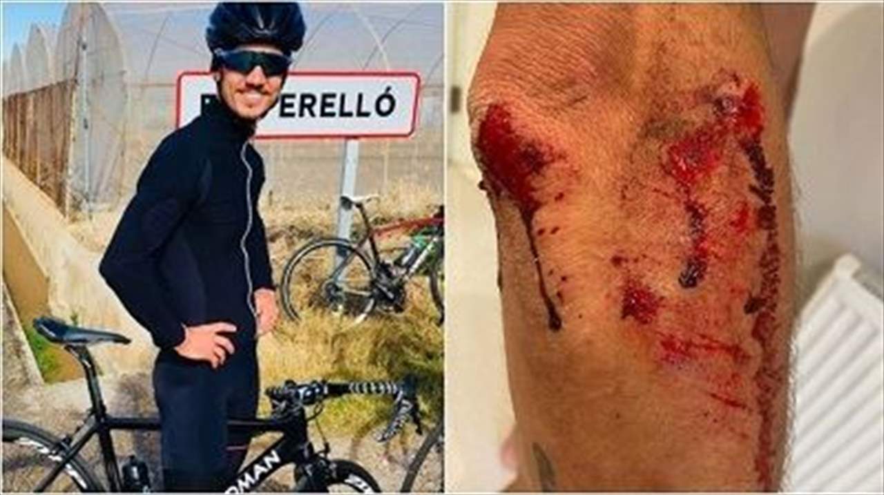هاجموا الرياضي الشهير وهددوه بمنجل وسرقوا درّاجته الباهظة الثمن