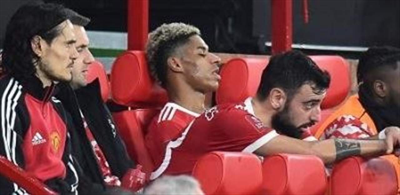 ماذا يحصل مع ماركوس راشفورد بدنياً وعقلياً!؟