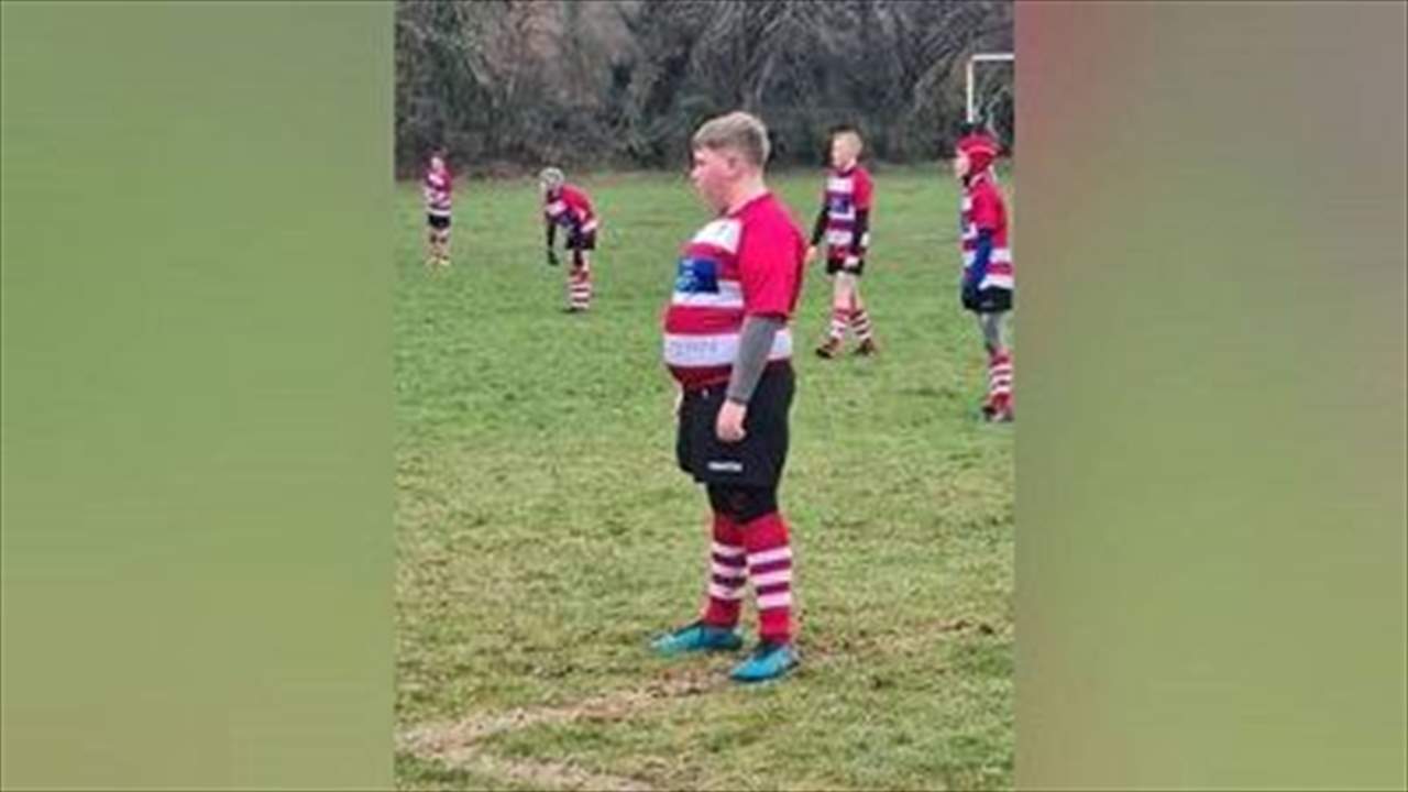 ​صورة - "الولد السمين" يهزم التنمر ويحظى بدعم واسع