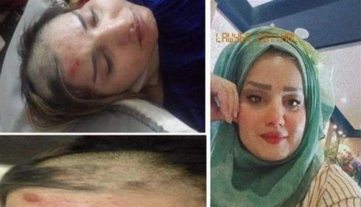 بالصور ـ في العراق .. 3 أشقاء يحلقون شعر شقيقتهم طمعًا في أموالها ولم يشفع لها تنازلها عن الإرث !