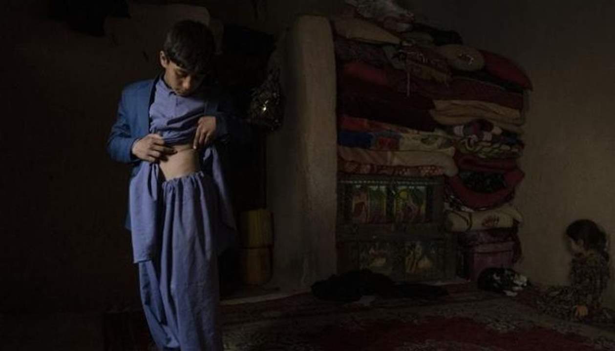 بالصور ـ قصص مأساوية .. أفغان يبيعون كلى أبنائهم من أجل الطعام !