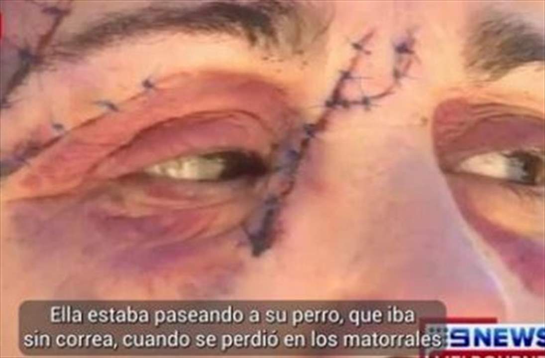 فيديو - كنغارو يهاجم إمرأة بعنف في ملعب للغولف