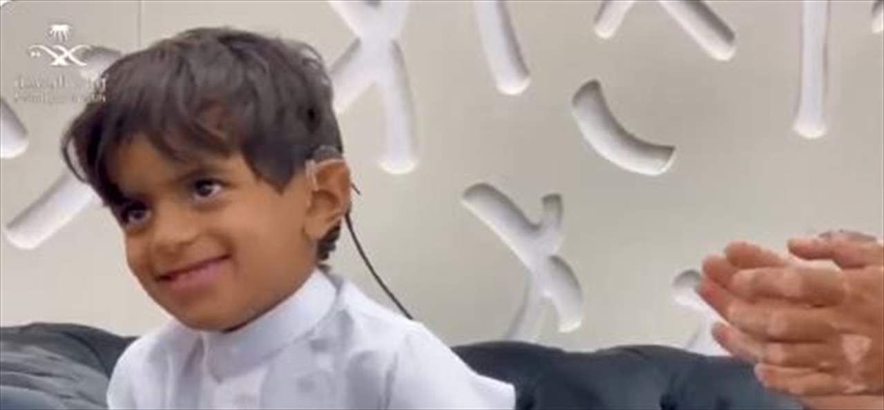 بالفيديو ـ بعد نجاح عملية زراعة قوقعة في الأذنين .. ضحكات طفل سعودي يسمع للمرة الأولى تخطف القلوب !
