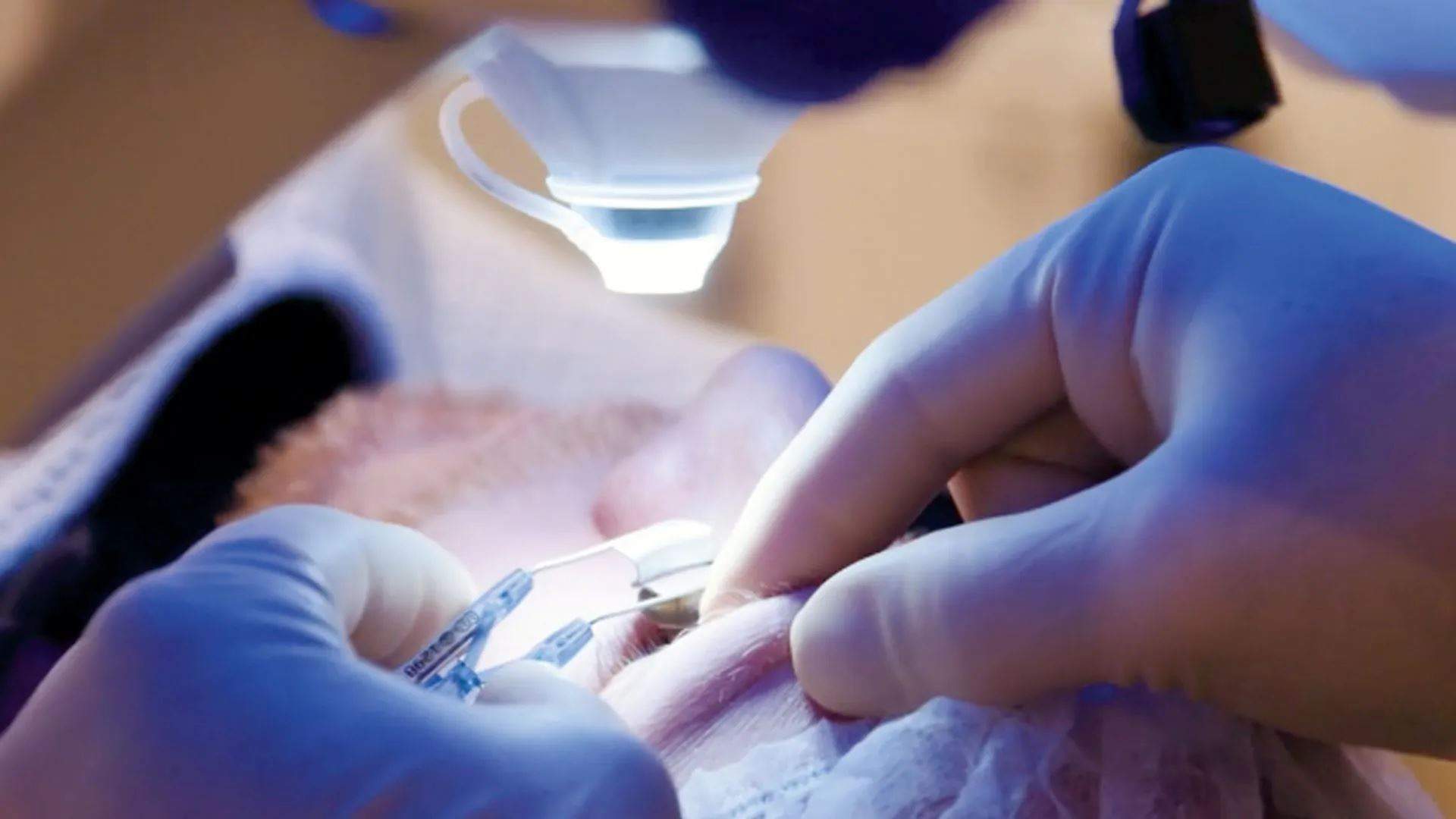 دخل المستشفى لعلاج عينه .. فخرج أعمى !