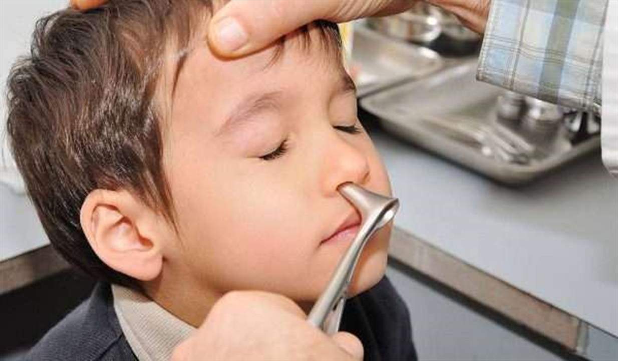 ظلت عالقة 10 سنوات.. مراهق يخرج "مفاجأة" من أنفه