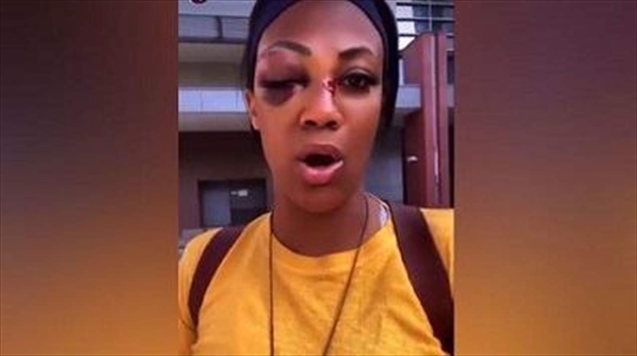 فيديو - الاعتداء على البطلة الأولمبية تركها متوّرمة