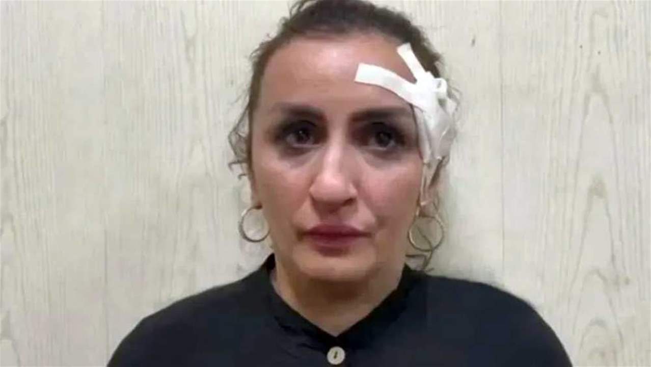 في روسيا .. أم تبيع رضيعتها من أجل عملية تجميل !!