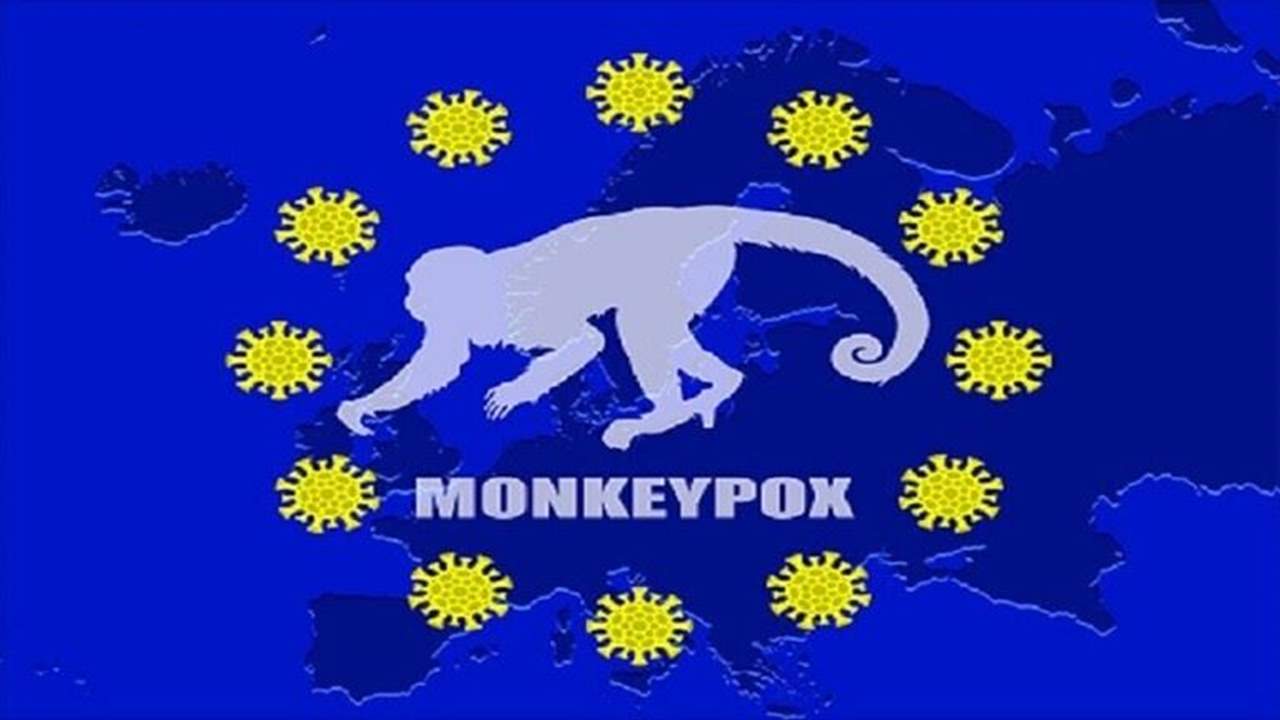 عالم أوبئة روسي يكشف شروط الحجر الصحي للمصابين بجدري القردة