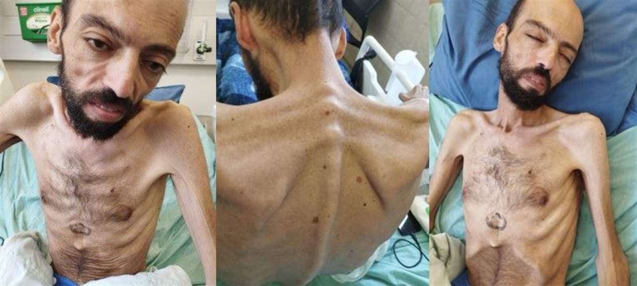 بالصور ـ  الأسير الفلسطيني المضرب خليل عواودة يتحول إلى "هيكل عظمي"..والاتحاد الأوروبي يطالب بالإفراج عنه