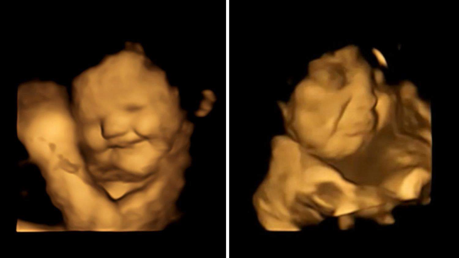   بالفيديو ـ مشاهد مذهلة توضح ضحك الجنين في بطن أمه بسبب نوعية الطعام !