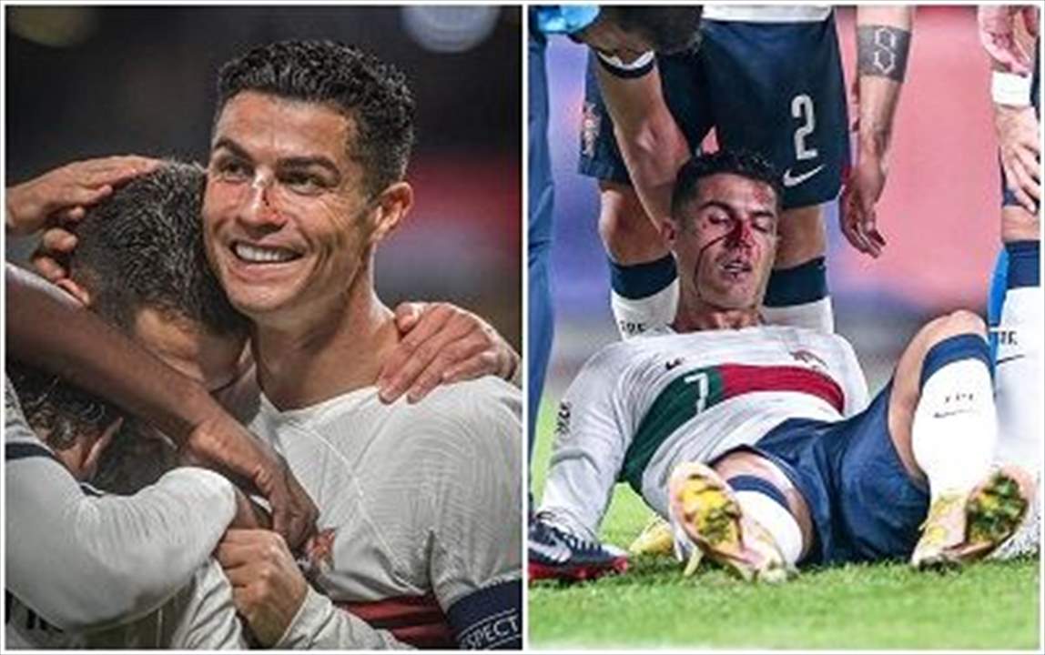 بالفيديو - إصابة رونالدو التي شغلت بال العشاق