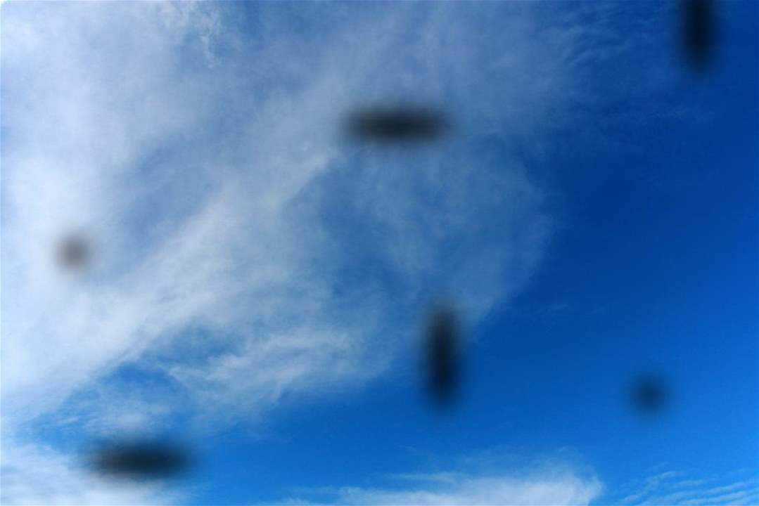   رؤية الذباب الطائر أمام العين قد يُشير إلى مرض خطير !