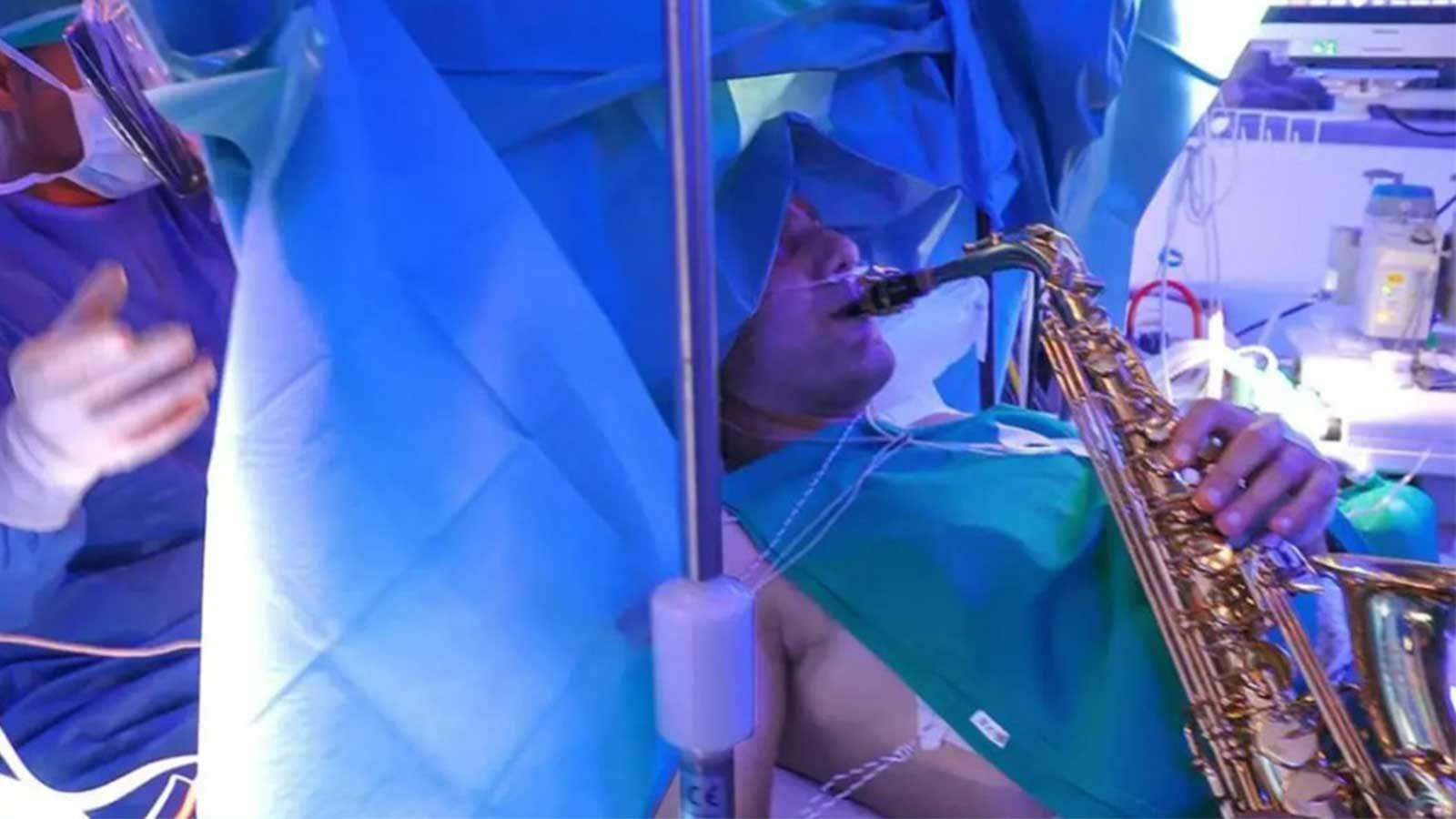 لمدة 9 ساعات متواصلة .. فنان يقدّم وصلة موسيقية أثناء خضوعه لجراحة في المخ !