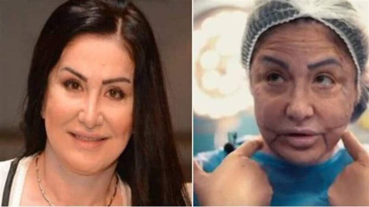 وفاء سالم تتصدر حديث المتابعين بأحدث ظهور لها بعد تشوه وجهها