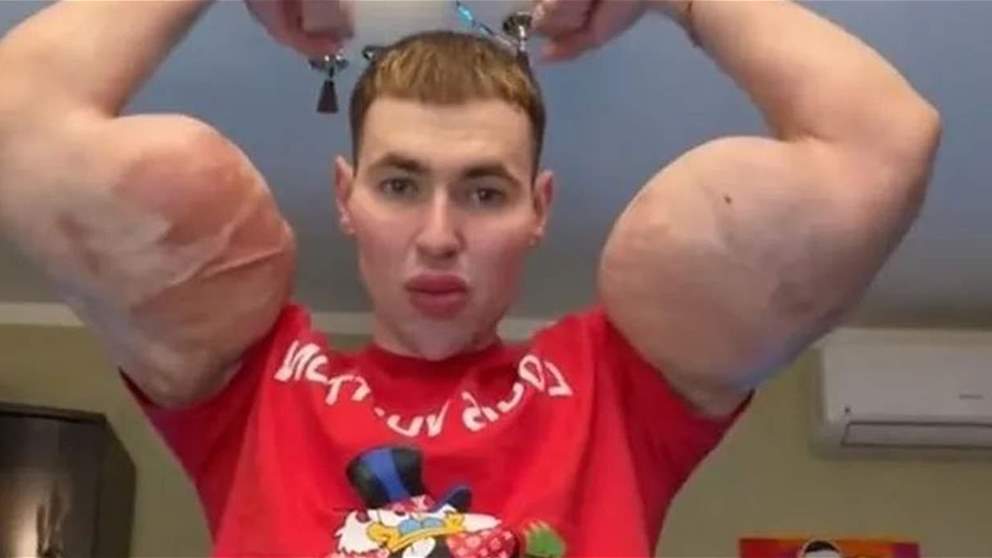 بعد عملية تجميل جديدة.. هذا ما حصل مع "بوباي روسيا" !