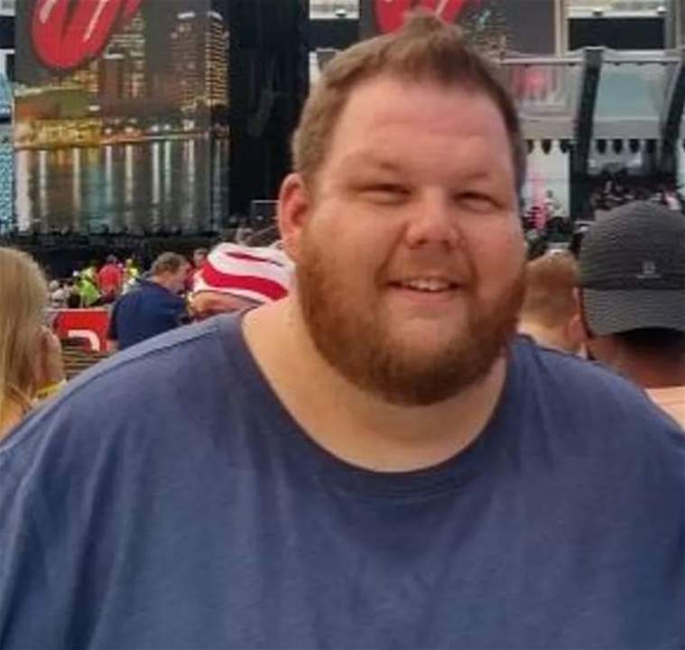 صورة صادمة لرجل خسر 152 كيلو من وزنه!