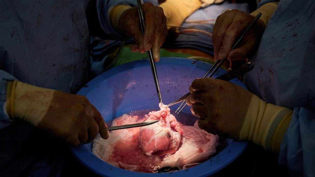 "الأولى من نوعها في العالم" .. نجاح زراعة قلب متوقف عن النبض بجسم آخر في إيطاليا !