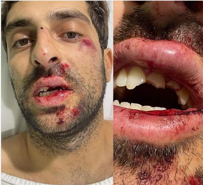 إعتداء على الناشط "نينو فنيانوس" في الكرنتينا .. اليكم ماحدث! 