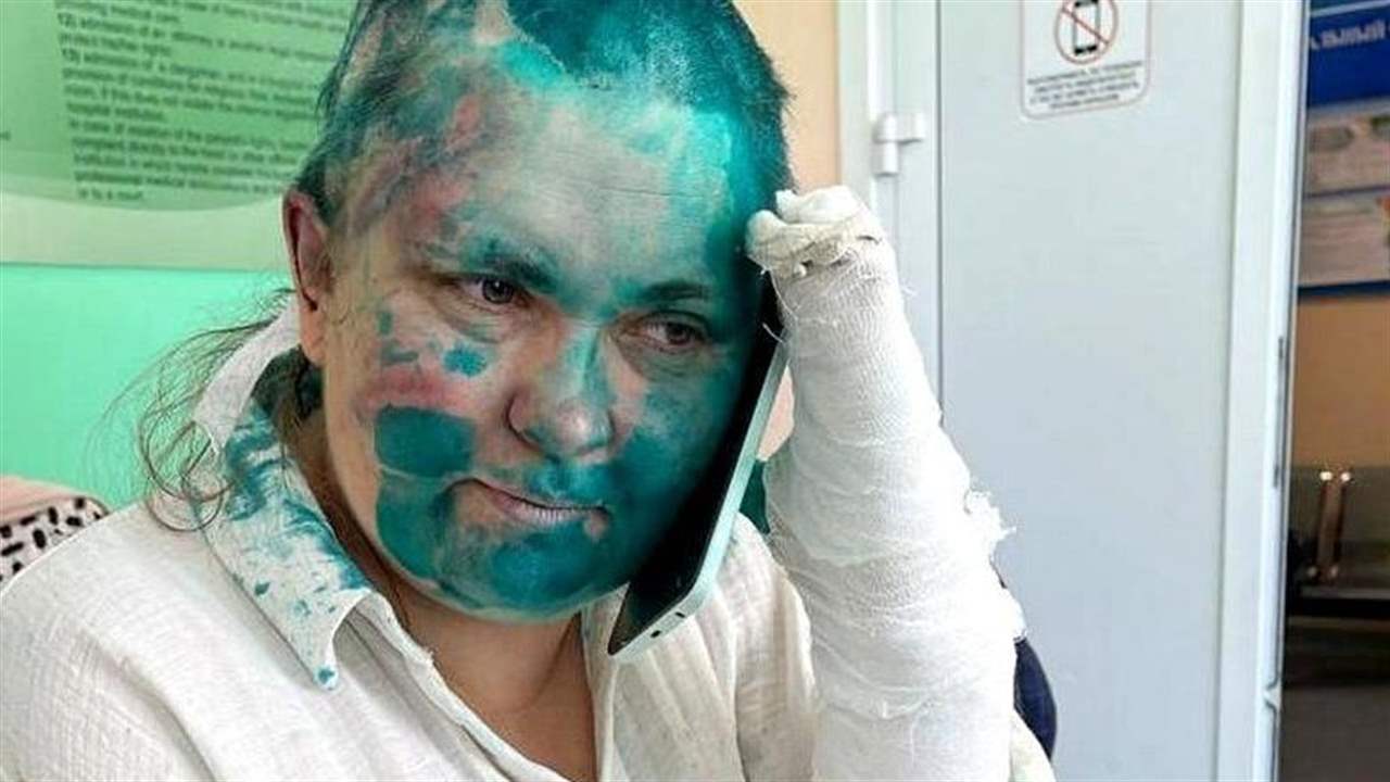 نقل صحافية روسية تعرضت لضرب مبرح في الشيشان إلى مستشفى في موسكو