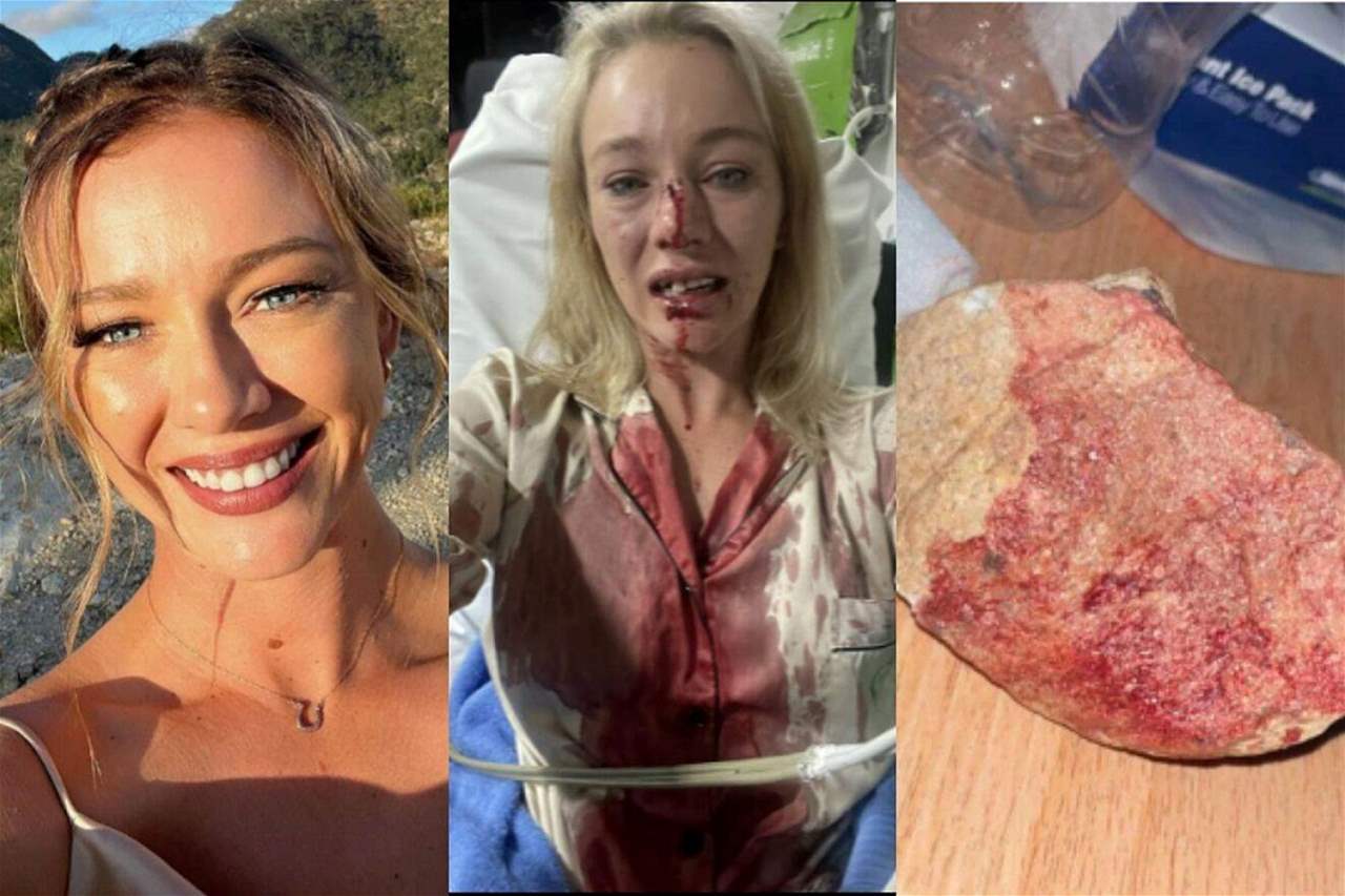 فارسة تتعرض لاعتداء صارخ قبل زواجها بثلاثة أسابيع !!