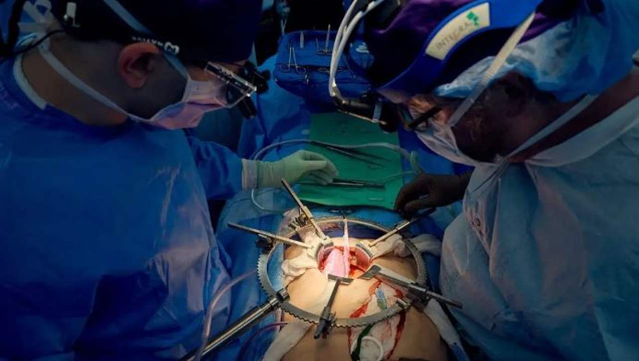 تطور علمي لافت .. كلية خنزير تواصل العمل بعد شهر على زرعها في جسد رجل