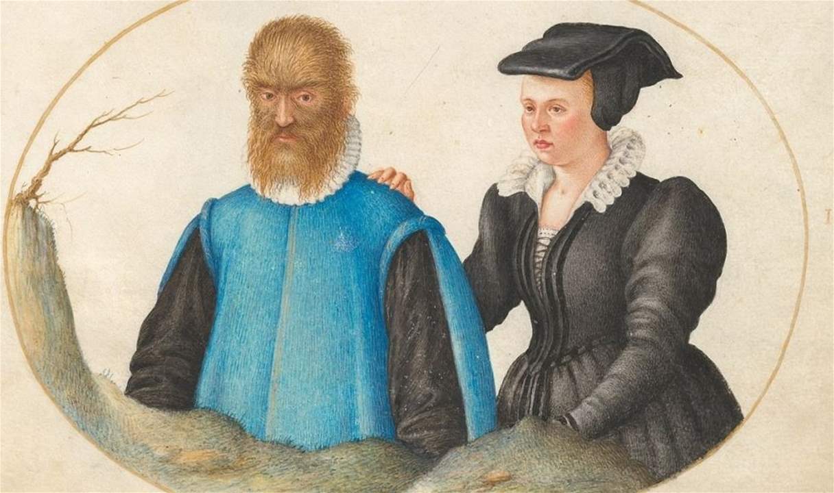 حدثت في بلاط الملك هنري الثاني وتفاصيلها مأساوية.. القصة الحقيقية لرائعة ديزني "الجميلة والوحش"