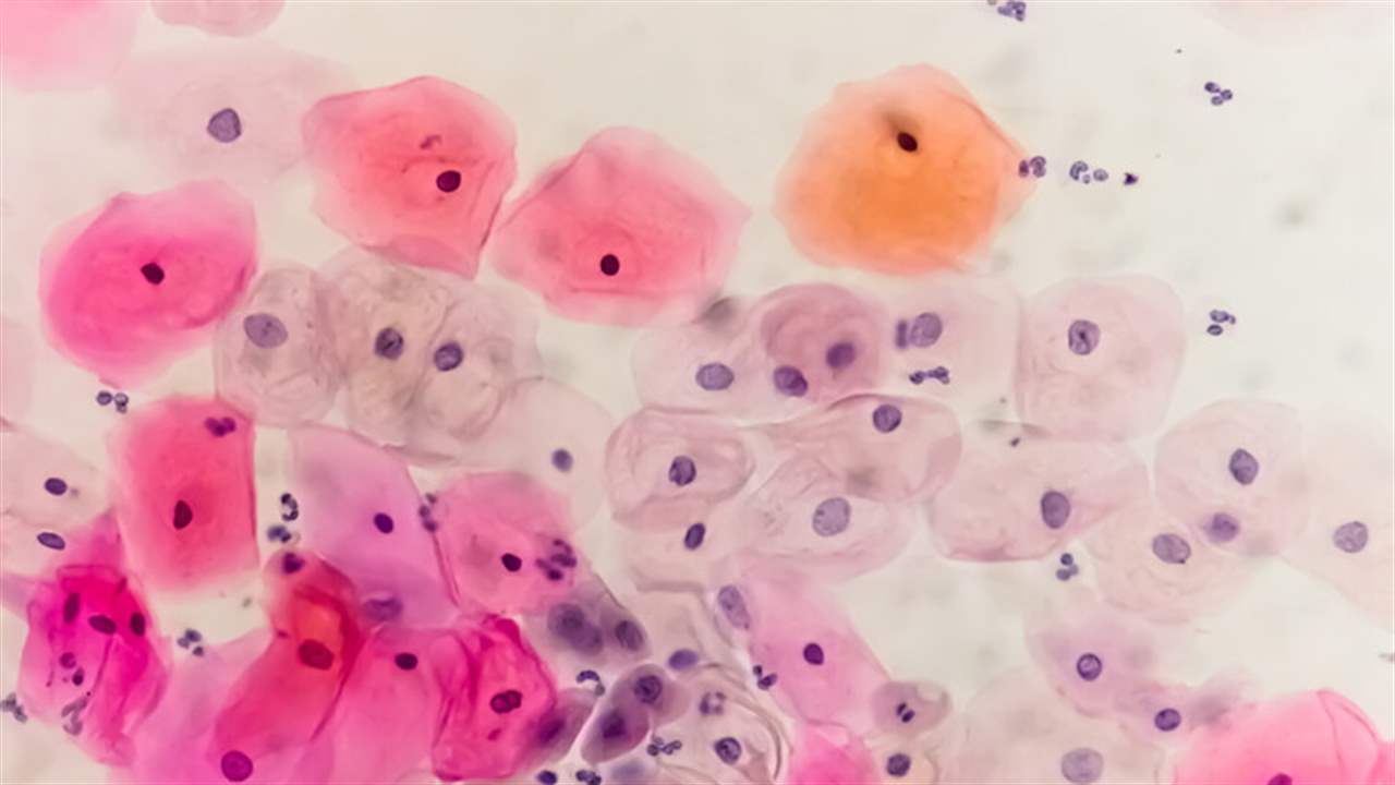 دراسة : واحد من كل ثلاثة رجال يصاب بعدوى منقولة جنسيا يعتقد أنها تصيب النساء فقط