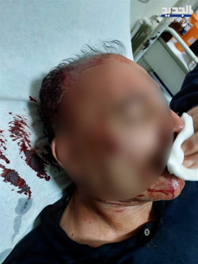  تعرّض المهندس عبدالله حنا الى "إعتداء بالضرب المبرح".. ميريام سكاف: ليس من بينكم رجال للمواجهة المكشوفة