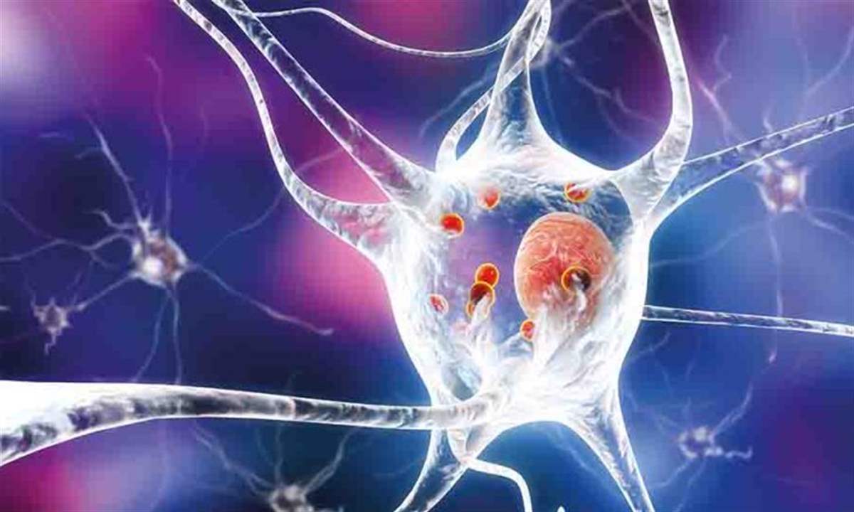 طفرة نادرة قد تقود العلماء إلى علاج جديد لباركنسون